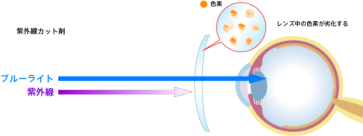 紫外線カット材によるレンズ中の色素の保護のイメージ