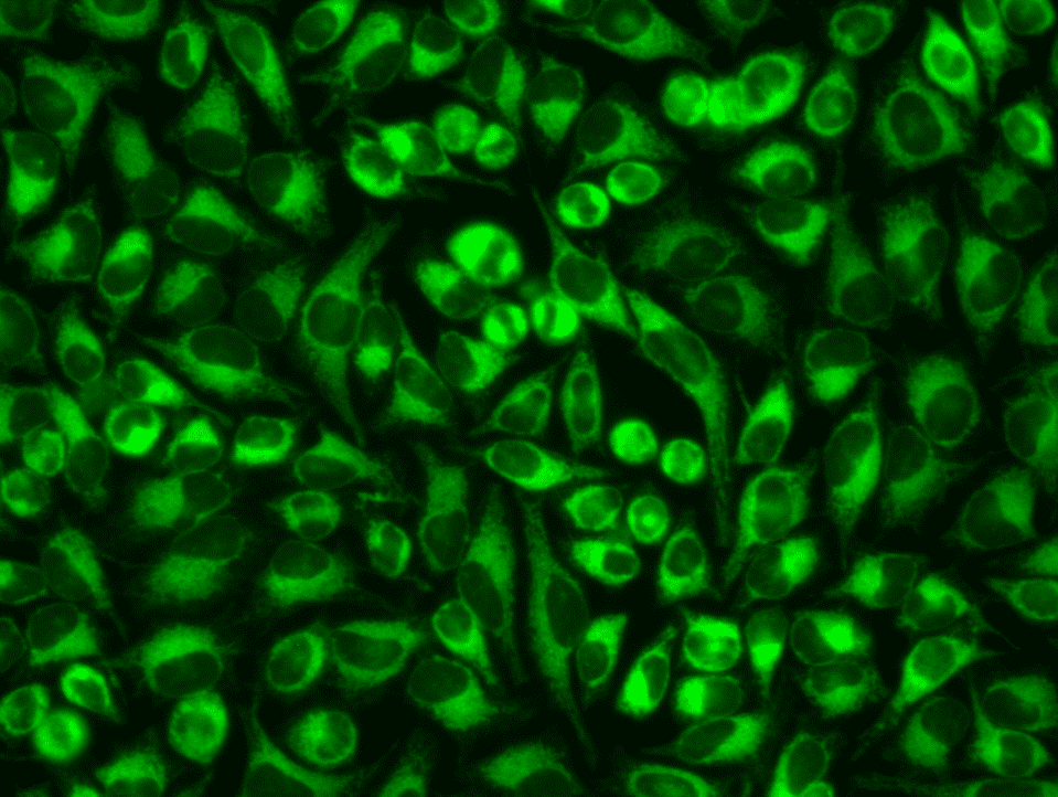 Near-infrared fluorescent probe for high-sensitivity imaging